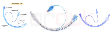 Endotracheal Tubes with Cuff